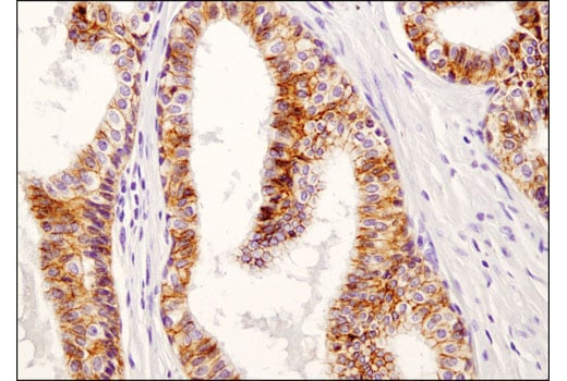 Immunohistochemistry Image 3: IGF-I Receptor beta (D4O6W) Rabbit Monoclonal Antibody