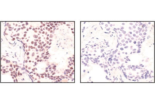 undefined Image 13: Double Strand Breaks (DSB) Repair Antibody Sampler Kit