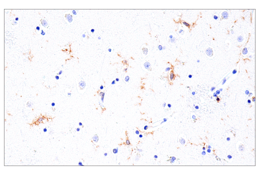 Immunohistochemistry Image 2: GM-CSF Receptor alpha (E8Z3S) Rabbit Monoclonal Antibody