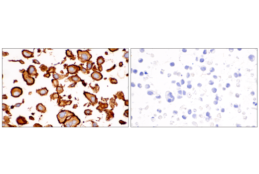 undefined Image 81: Pericyte Antibody Sampler Kit