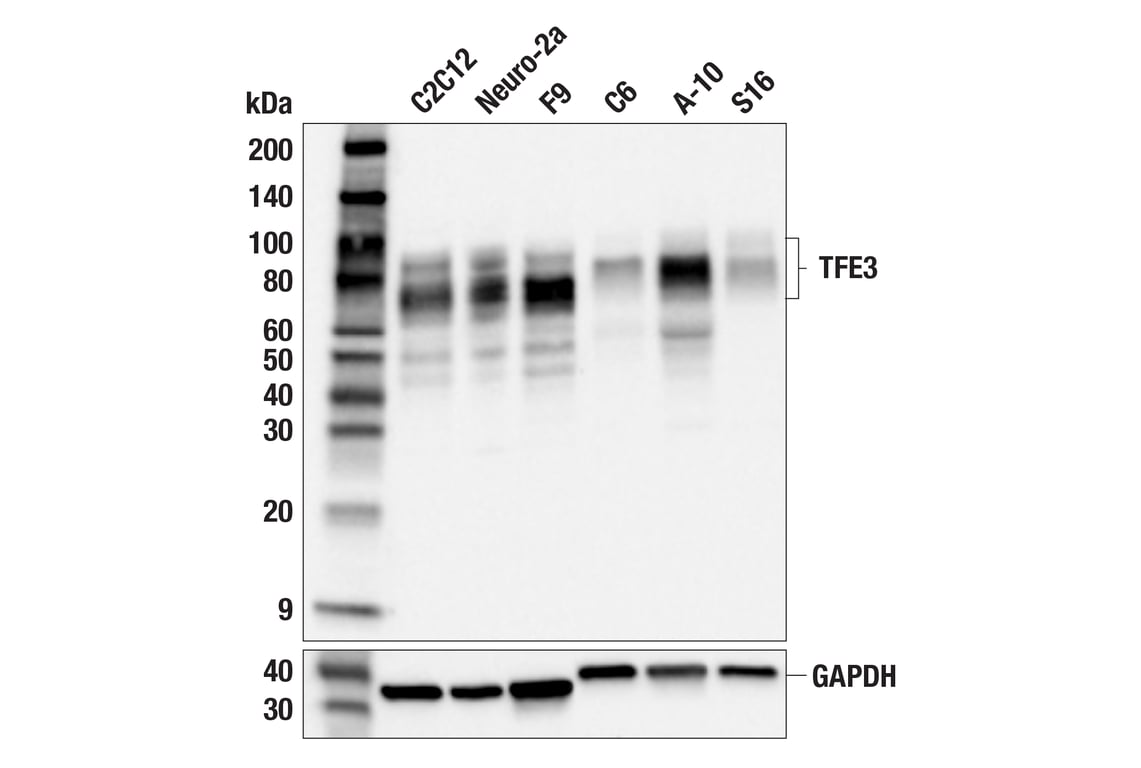 Western Blotting Image 2: TFE3 (F3Z2Q) Rabbit Monoclonal Antibody