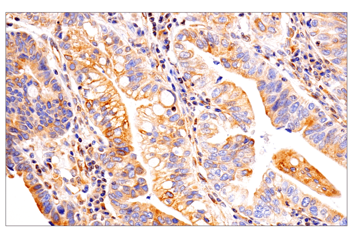 Immunohistochemistry Image 17: HLA-E (MEM-E/02) Mouse Monoclonal Antibody