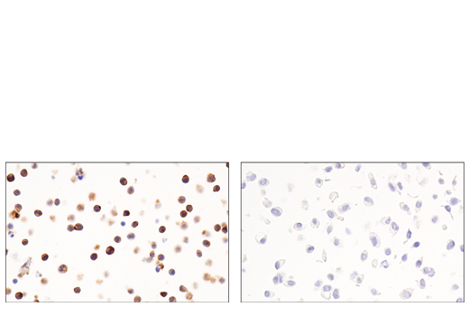 Immunohistochemistry Image 8: CD54/ICAM-1 (E3Q9N) Rabbit Monoclonal Antibody (BSA and Azide Free)