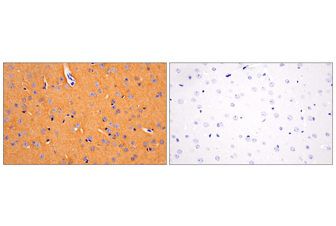 Phospho-Tau (Ser396) (F3S9T) Rabbit mAb | Cell Signaling