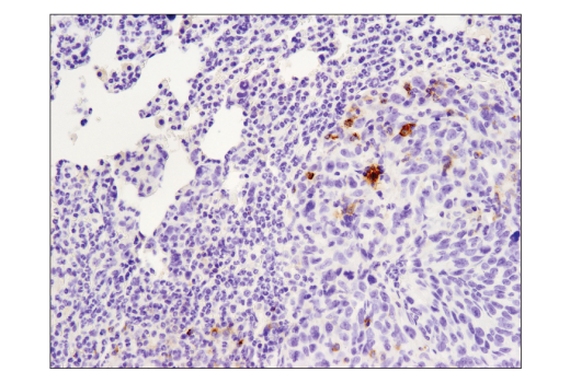 Immunohistochemistry Image 4: PD-L1 (D5V3B) Rabbit Monoclonal Antibody (BSA and Azide Free)