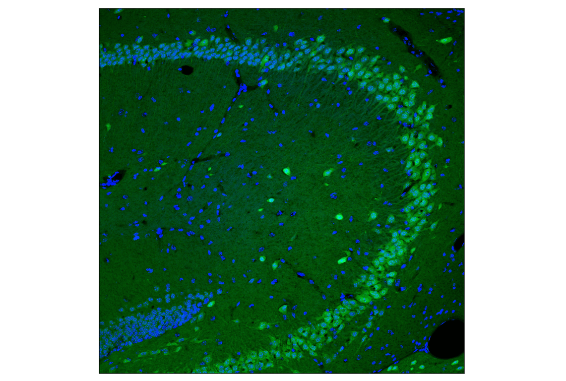 Immunofluorescence Image 2: CRBN (F4I7F) Rabbit mAb