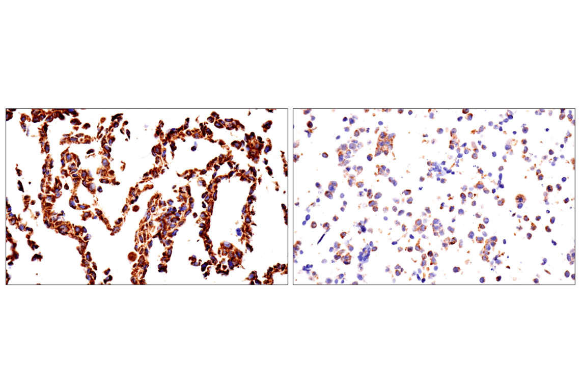 Immunohistochemistry Image 14: TSPO (F5B8F) Rabbit Monoclonal Antibody