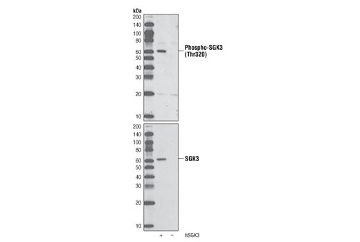 Western Blotting Image 2: Phospho-SGK3 (Thr320) (D30E6) Rabbit Monoclonal Antibody