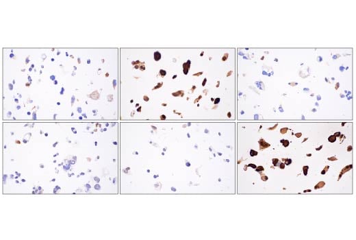 Immunohistochemistry Image 4: YAP (D8H1X) Rabbit Monoclonal Antibody (BSA and Azide Free)