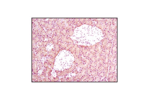 Immunohistochemistry Image 2: alpha-Amylase (D55H10) Rabbit Monoclonal Antibody