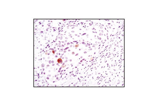 Immunohistochemistry Image 1: Phospho-Chk2 (Thr68) (C13C1) Rabbit Monoclonal Antibody (BSA and Azide Free)