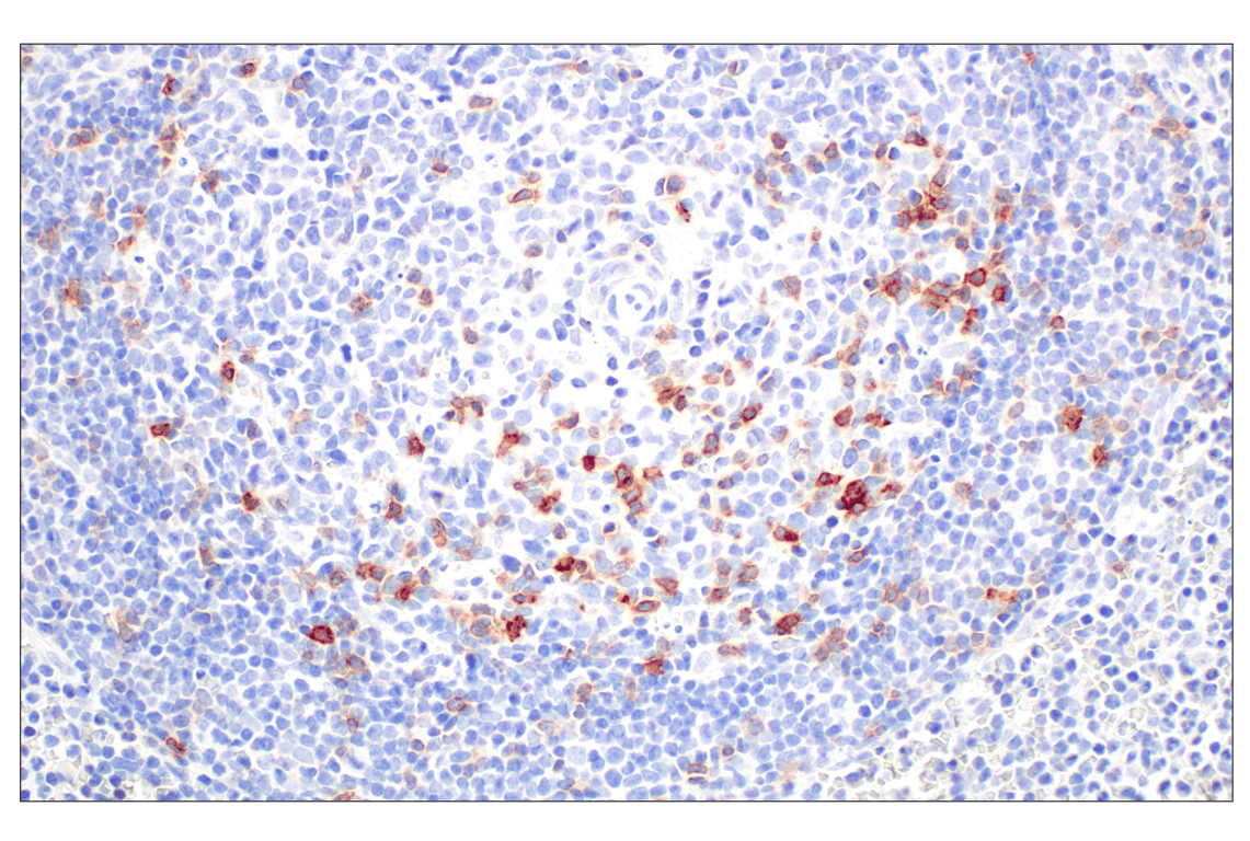 Immunohistochemistry Image 5: ICOS (D1K2T) Rabbit Monoclonal Antibody