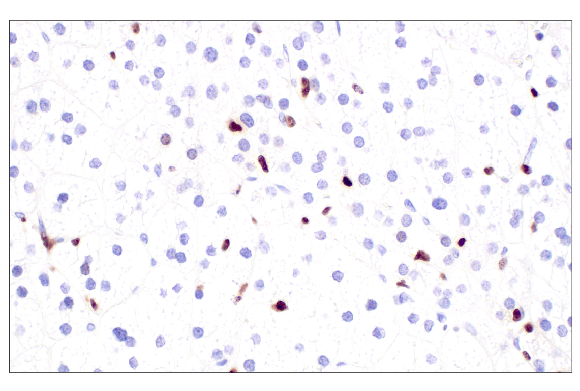 Immunohistochemistry Image 9: MNDA (3C1) Rat Monoclonal Antibody