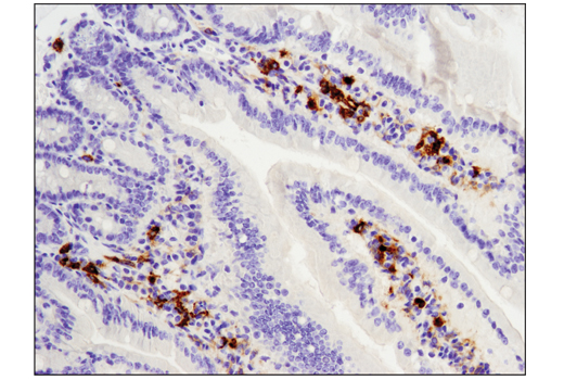 Immunohistochemistry Image 1: TIM-3 (D3M9R) Rabbit Monoclonal Antibody (BSA and Azide Free)