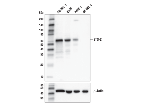 Western Blotting Image 1: ETS-2 (D6L4J) Rabbit mAb