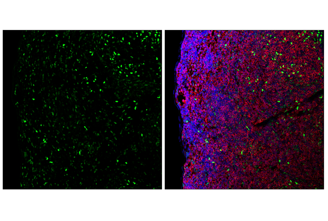 Immunofluorescence Image 3: TCF4/ITF2 (E3X2Y) Rabbit Monoclonal Antibody