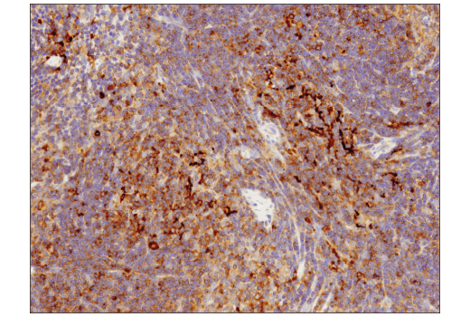 Immunohistochemistry Image 4: SQSTM1/p62 (D6M5X) Rabbit Monoclonal Antibody