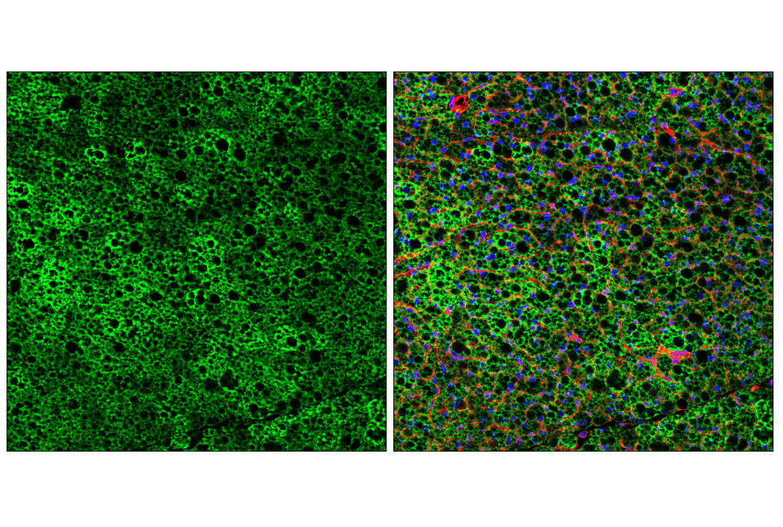 Immunofluorescence Image 2: SLC25A1 (E7B2B) Rabbit Monoclonal Antibody