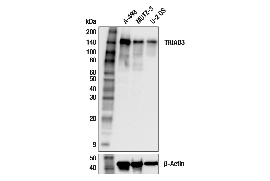 Western Blotting Image 2: TRIAD3 (F1Z2P) Rabbit Monoclonal Antibody