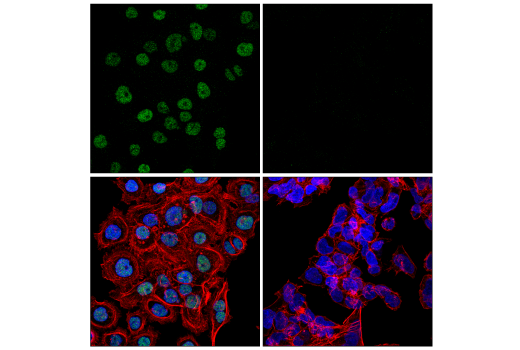 Immunofluorescence Image 1: KLF5 (E5K6H) Rabbit Monoclonal Antibody