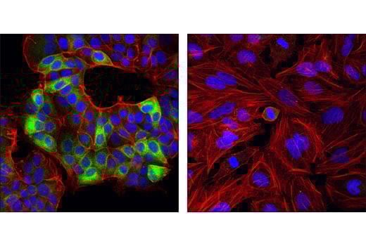 Immunofluorescence Image 1: Ret (C31B4) Rabbit Monoclonal Antibody