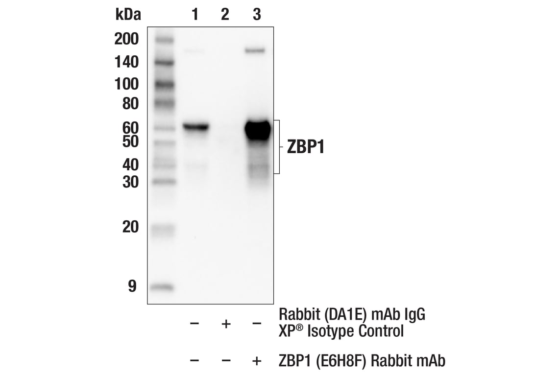 Immunoprecipitation Image 1: ZBP1 (E6H8F) Rabbit Monoclonal Antibody