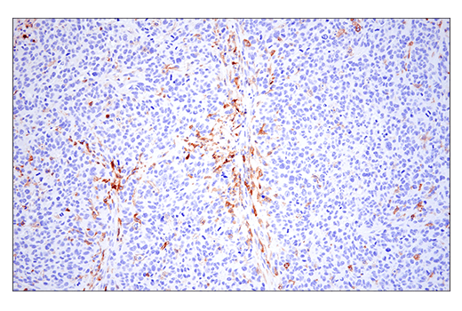 Immunohistochemistry Image 2: CD86 (E5W6H) Rabbit Monoclonal Antibody
