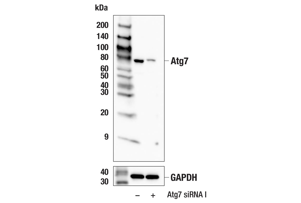 Western Blotting Image 2: Atg7 (E4J3X) Rabbit Monoclonal Antibody