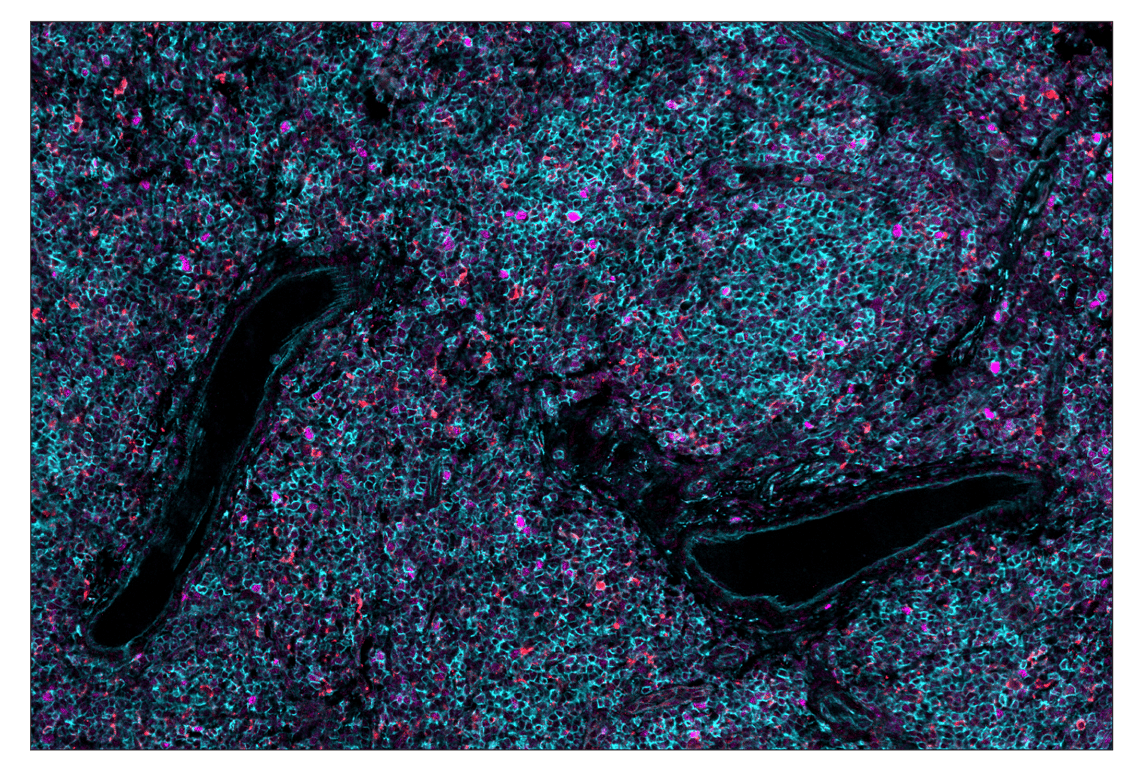 Immunohistochemistry Image 2: PCNA (D3H8P) & CO-0090-647 SignalStar<sup>™</sup> Oligo-Antibody Pair