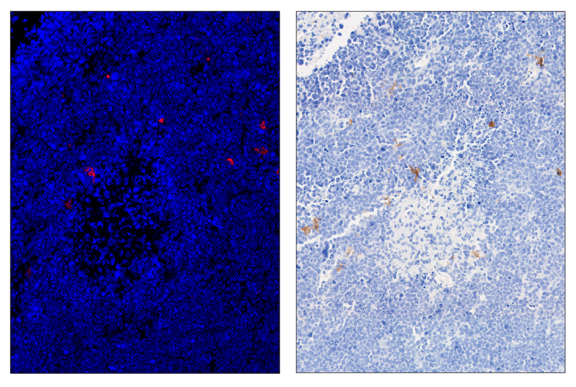 Immunohistochemistry Image 5: iNOS (E1W4J) & CO-0179-488 SignalStar<sup>™</sup> Oligo-Antibody Pair