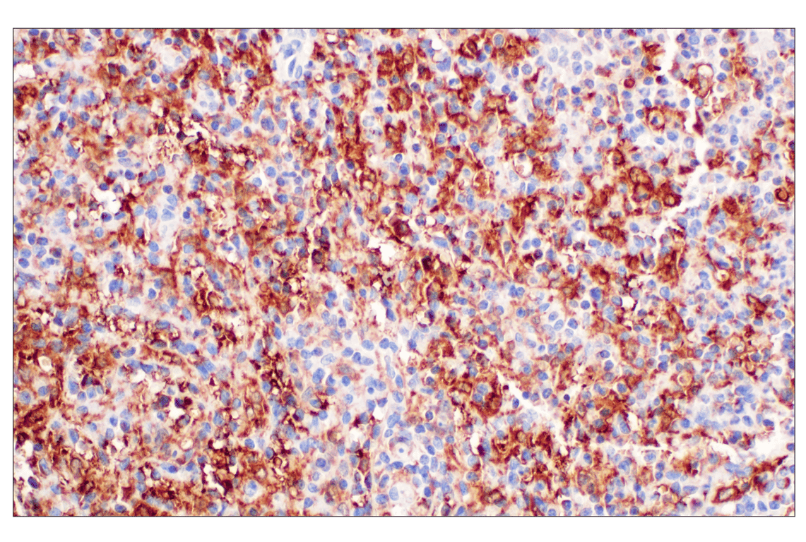 Immunohistochemistry Image 6: SHMT1 (F5Q3S) Rabbit Monoclonal Antibody