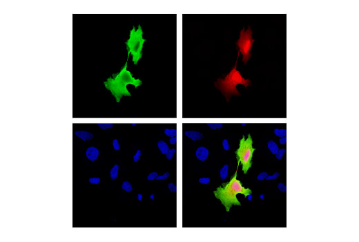 Immunofluorescence Image 1: mCherry (E5D8F) Rabbit Monoclonal Antibody