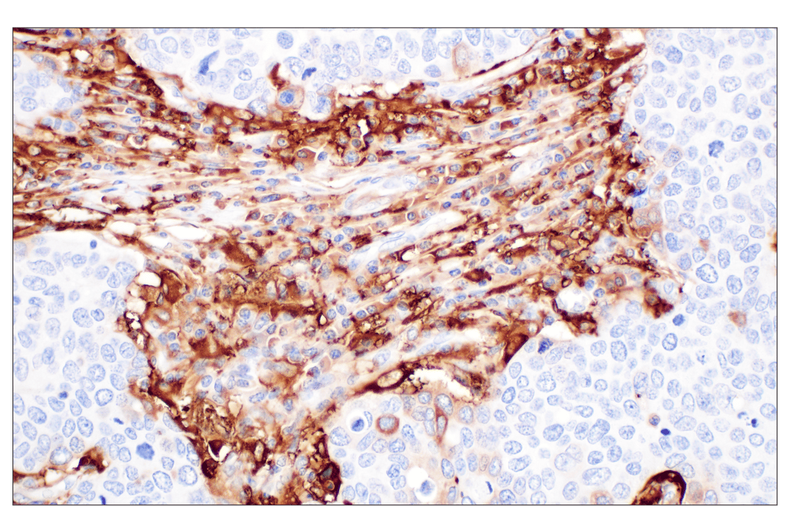 Immunohistochemistry Image 2: FTL (F9O4I) Rabbit Monoclonal Antibody