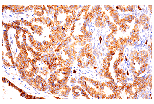 Immunohistochemistry Image 2: Insulin Receptor β (E9L5V) XP<sup>®</sup> Rabbit mAb (BSA and Azide Free)