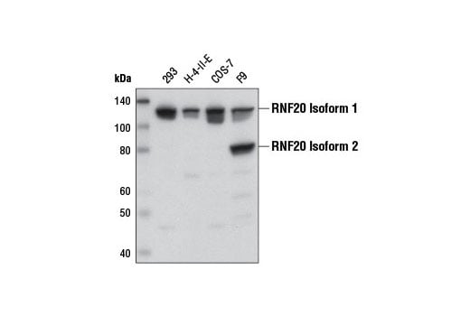 Western Blotting Image 1: RNF20 (D6E10) XP<sup>®</sup> Rabbit mAb