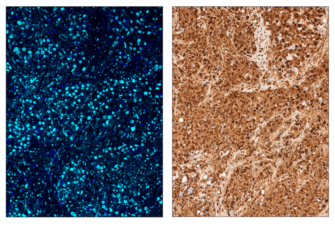 Immunohistochemistry Image 3: Fibronectin/FN1 (E5H6X) & CO-0203-594 SignalStar<sup>®</sup> Oligo-Antibody Pair