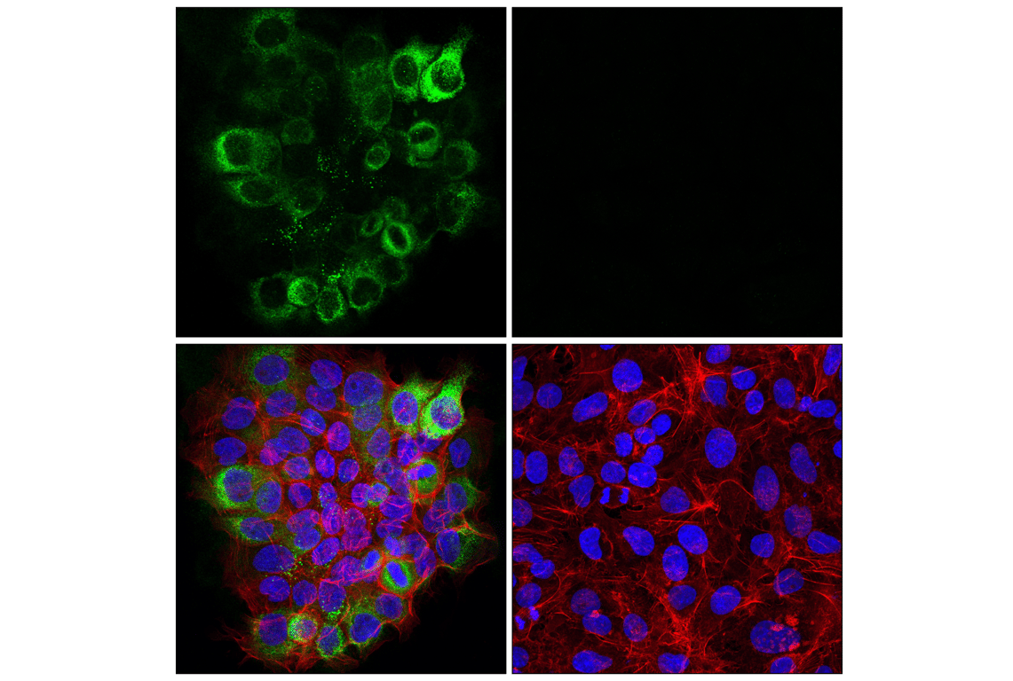 LAMC2 (E9F7M) Rabbit mAb | Cell Signaling Technology