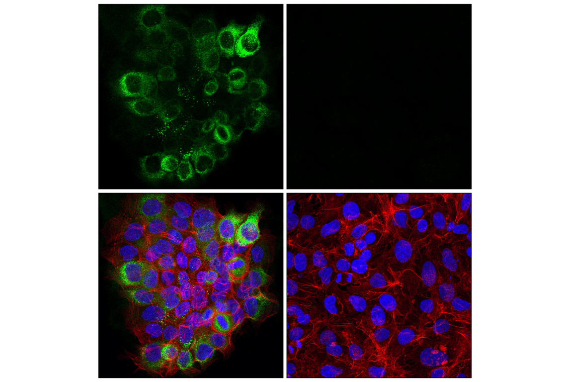 Immunofluorescence Image 1: LAMC2 (E9F7M) Rabbit mAb