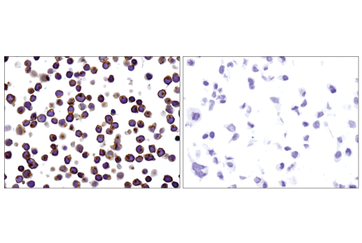 Immunohistochemistry Image 4: CD45 (Intracellular Domain) (D9M8I) Rabbit Monoclonal Antibody (BSA and Azide Free)