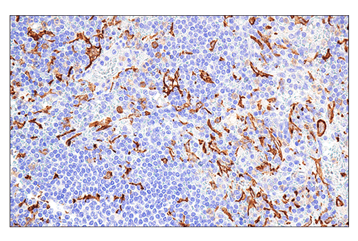 Immunohistochemistry Image 2: Iba1/AIF-1 (E4O4W) Rabbit Monoclonal Antibody (BSA and Azide Free)