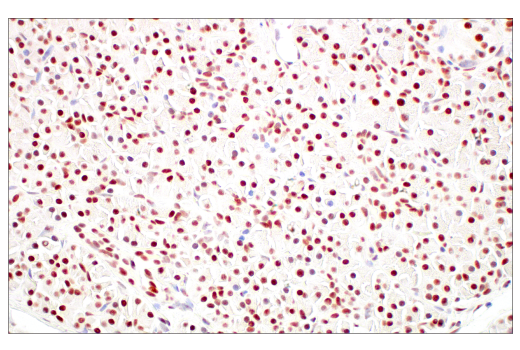 Immunohistochemistry Image 8: Rad50 (E4J5R) Rabbit Monoclonal Antibody
