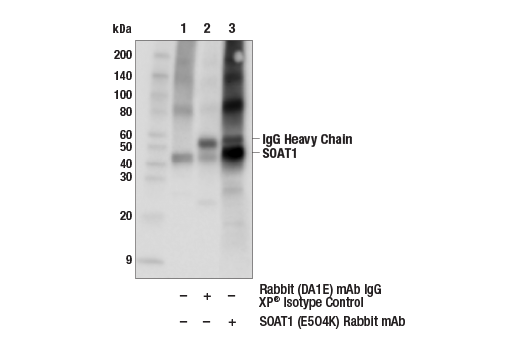Immunoprecipitation Image 1: SOAT1 (E5O4K) Rabbit Monoclonal Antibody