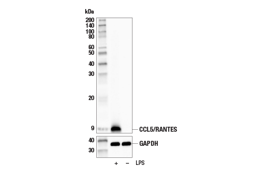 Western Blotting Image 3: CCL5/RANTES (E9S2K) Rabbit Monoclonal Antibody (BSA and Azide Free)