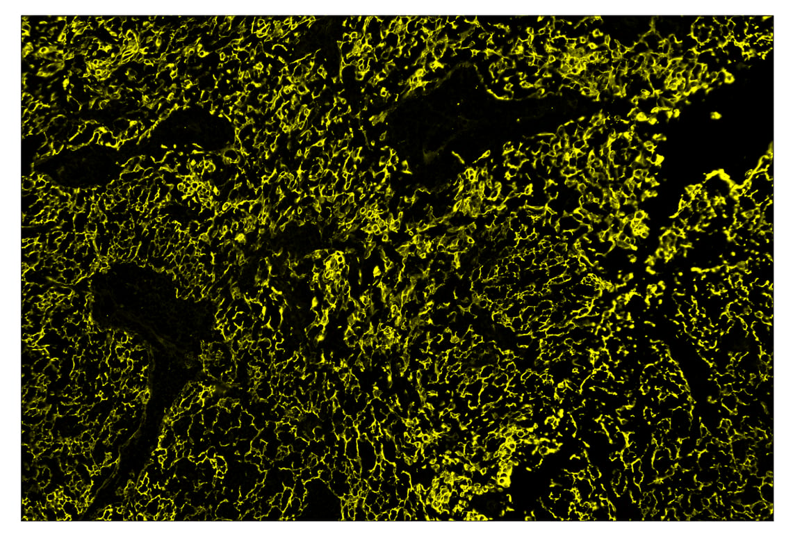 Immunohistochemistry Image 3: Pan-Keratin (Type I) (E6S1S) & CO-0072-750 SignalStar<sup>™</sup> Oligo-Antibody Pair