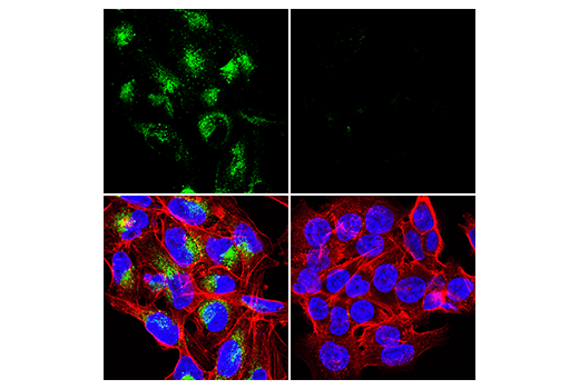 undefined Image 25: Extracellular Matrix Dynamics Antibody Sampler Kit