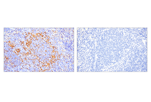 Immunohistochemistry Image 4: CD86 (E5W6H) Rabbit Monoclonal Antibody
