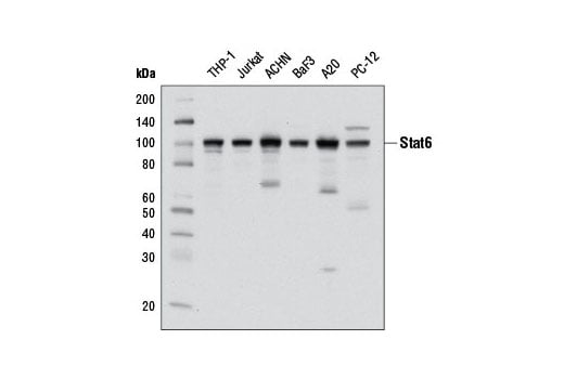 undefined Image 8: Stat Antibody Sampler Kit II