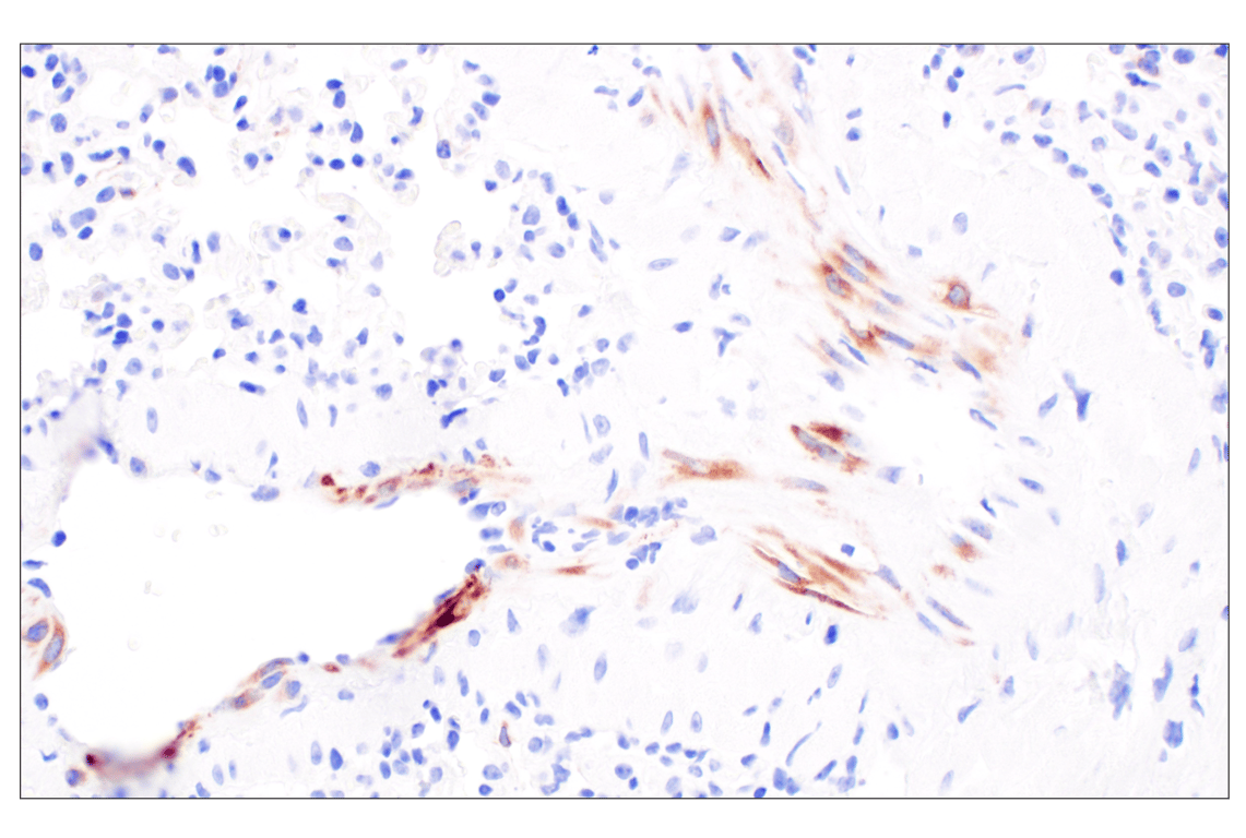 Immunohistochemistry Image 6: IGFBP2 (F3E6V) Rabbit Monoclonal Antibody