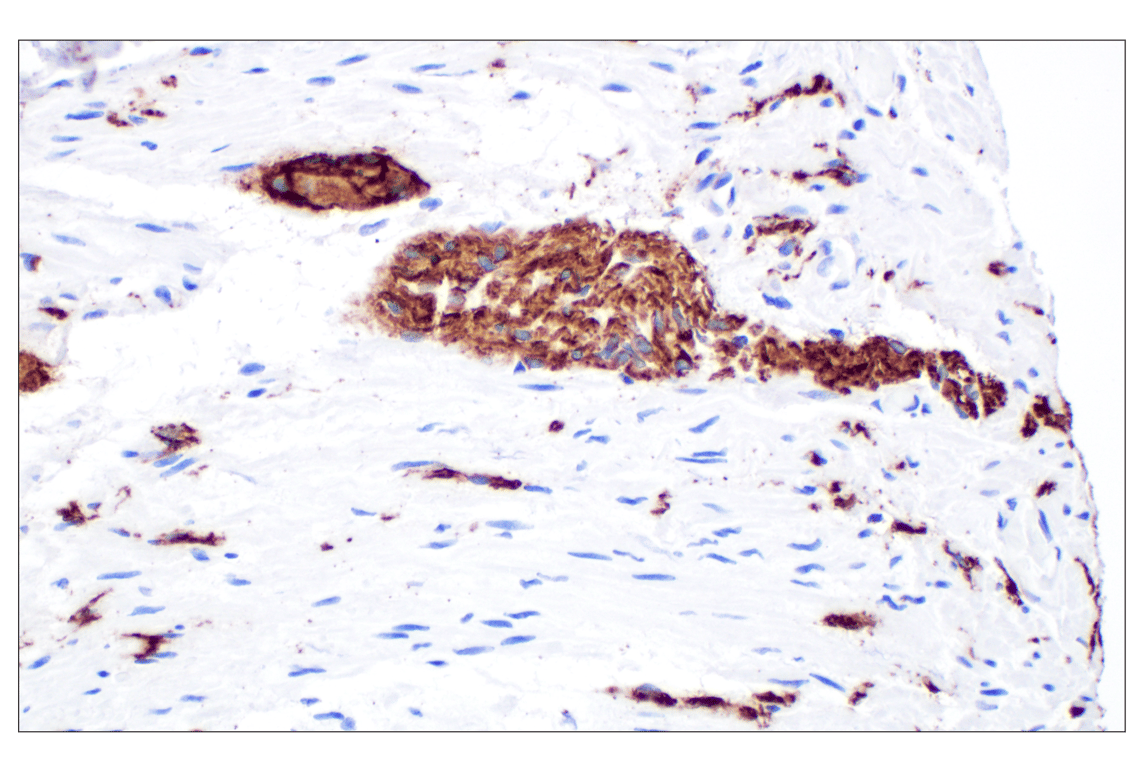 Immunohistochemistry Image 4: GAP43 (E6L2W) Mouse Monoclonal Antibody