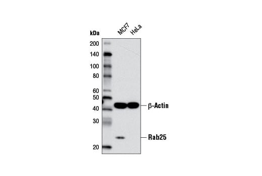 Western Blotting Image 2: Rab25 (D4P6P) Rabbit Monoclonal Antibody